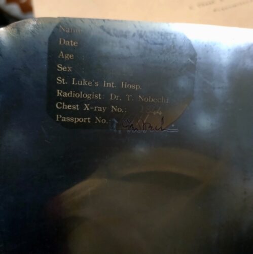 レントゲン写真２