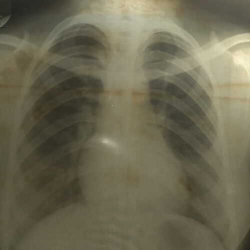 レントゲン　アイキャッチ